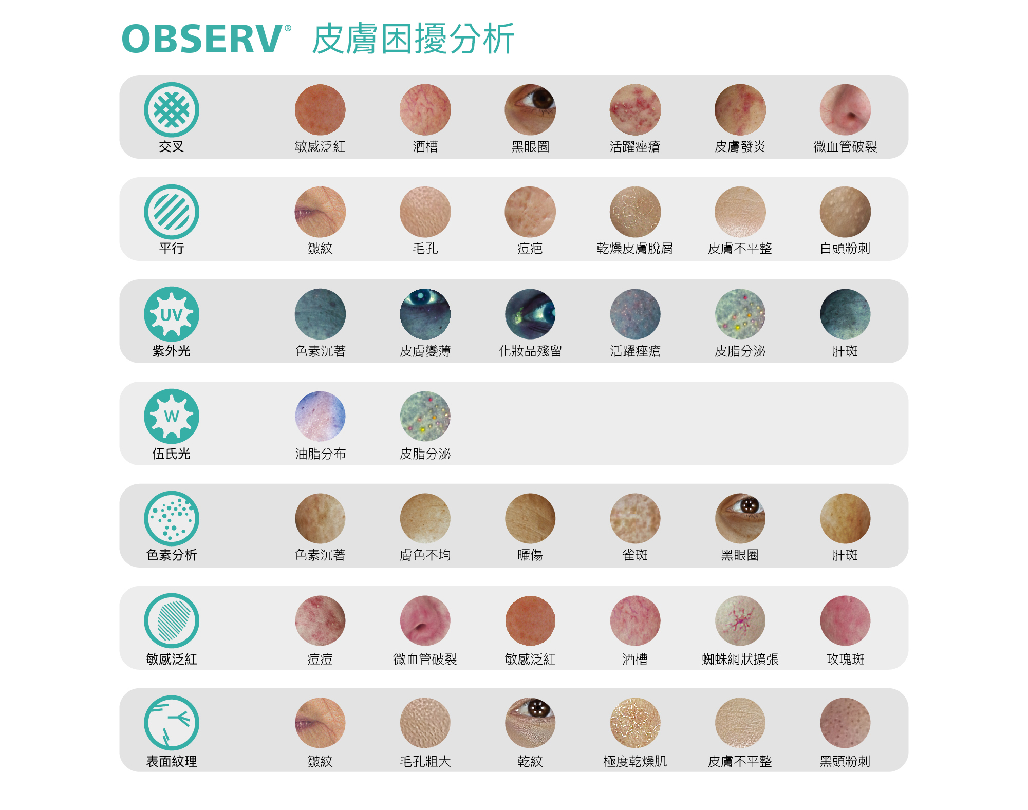 observ520x全臉肌膚檢測儀-05